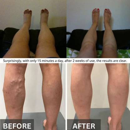 VivoTherix™ 3-in-1 Leg Massager