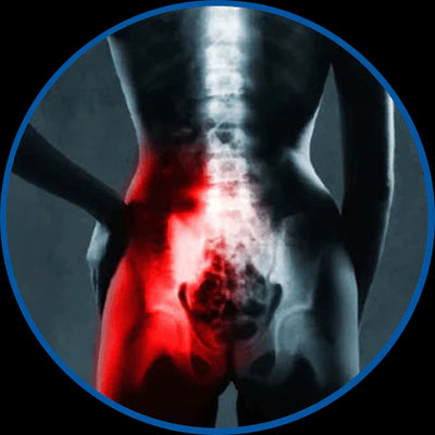 SI Joint Dysfunction